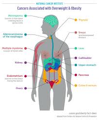 Researchers have connected type 2 diabetes to certain cancers linked to obesity.