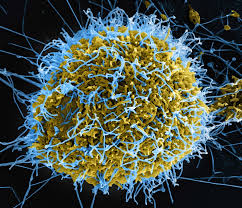 A doctor returning from the Democratic Republic of the Congo tests positive for the first Ebola case in France