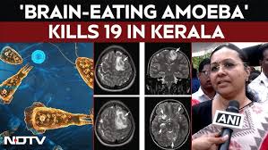 Kerala on alert as ‘Brain-Eating Amoeba’ kills 19! How it spreads 