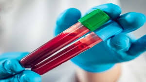 A Novel AI-Powered Blood Test Is Able to Spot Cancer Early
